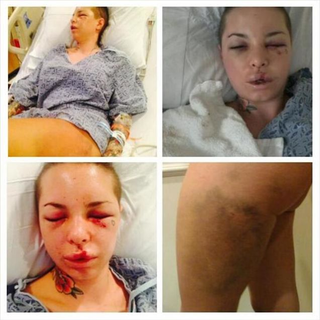 Illustration for article titled Christy Mack Releases Statement, Photos Following Attack